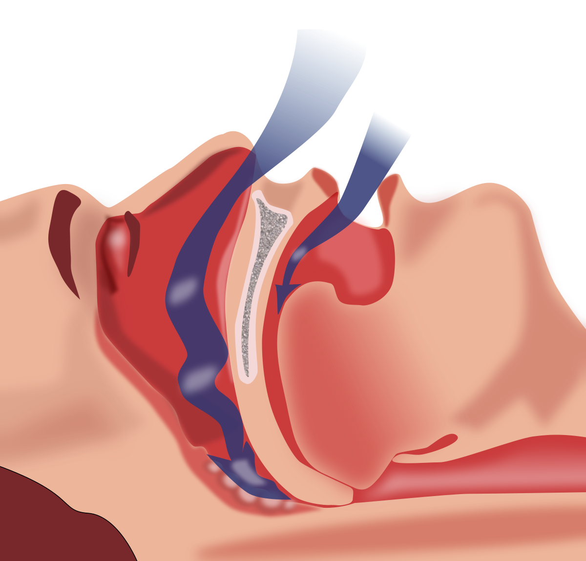 How Do You Know If You Have Sleep Apnea? A Comprehensive Guide